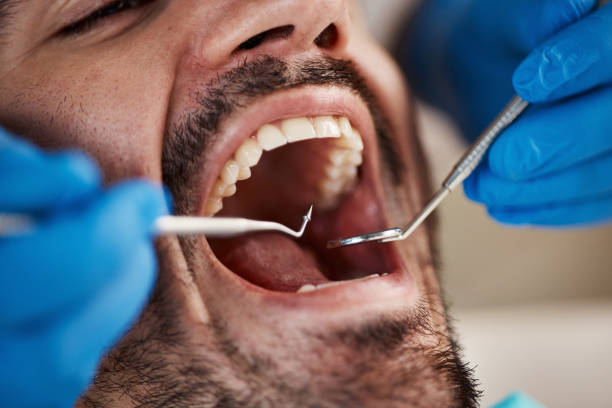 Best Emergency Dental Care for Broken or Chipped Teeth in Ione, CA